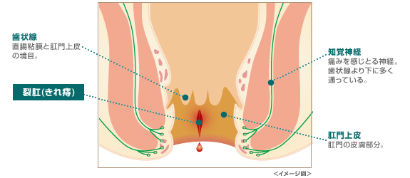 少量の出血と痛みが特徴