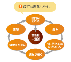 裂肛の悪化サイクル